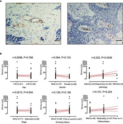 Long Distance From Microvessel to Cancer Cell Predicts Poor Prognosis in Non-Small Cell Lung Cancer Patients